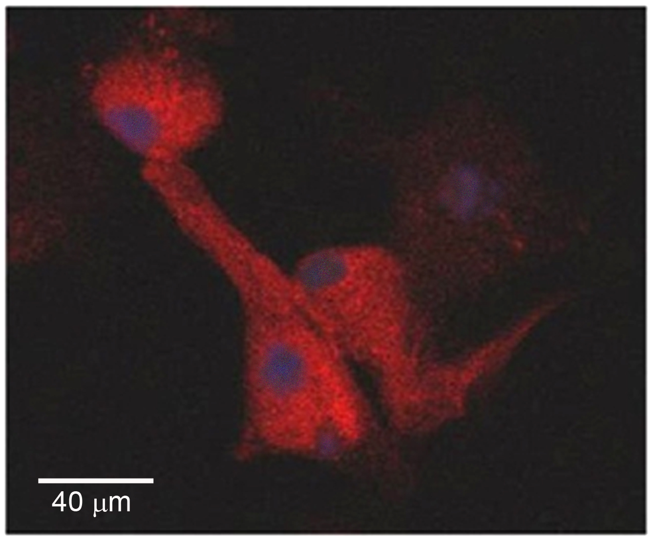 Inmunofluorescencia juanjo microbiologia