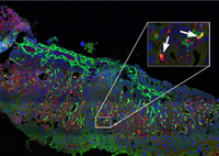 La UMA revela la existencia de dos linajes diferentes de células madre hematopoyéticas