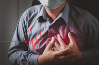 Un estudio detecta que la enfermedad arterial coronaria no obstructiva no está exenta de riesgo de eventos cardiovasculares futuros