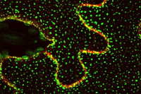 En la imagen usando microscopía confocal se ve la localización de la proteína Sinaptotagmina 1 unida a la proteína fluorescente GFP
