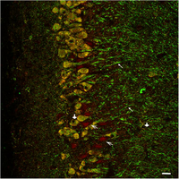 Neuroquimica de la transmision