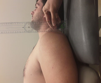 Test de distancia acromion-camilla y acromion-pared1