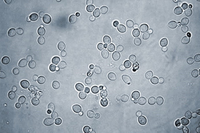 La levadura Saccharomyces cerevisiae, resistente a cisplatino, observada desde un microscopio