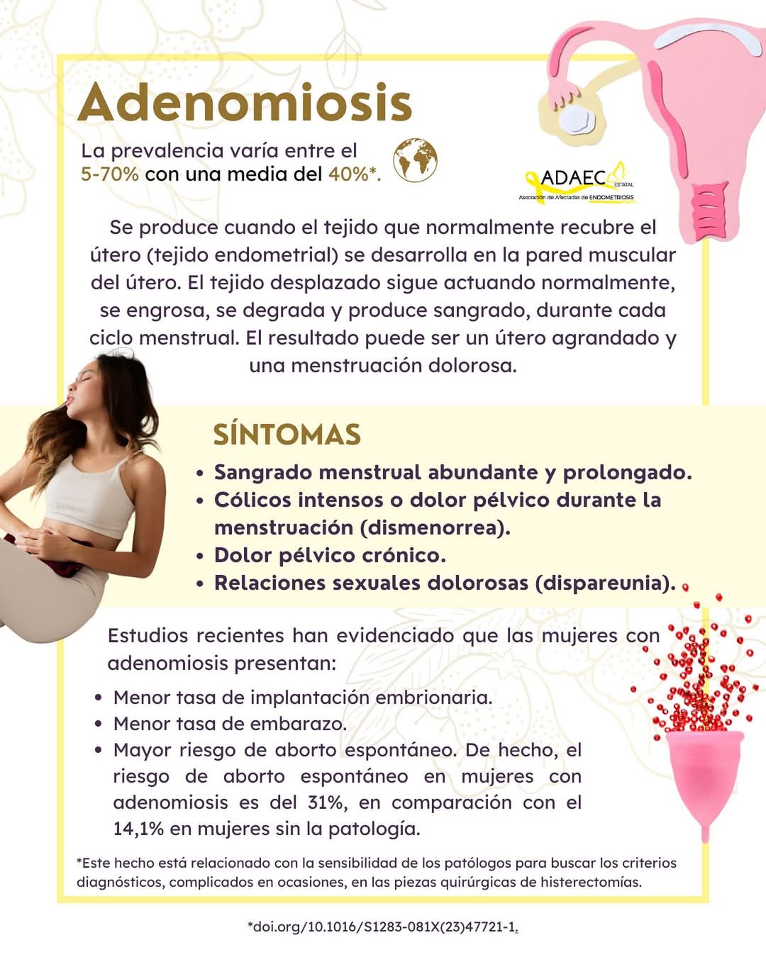 Mesa redonda adenomiosis
