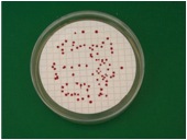 Placa analisis agua microbiologia
